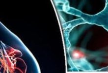 بهترین درمان ام اس با کمک طب سنتی